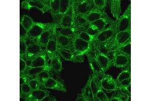 Immunofluorescent staining of HeLa cells. (beta-2 Microglobulin 抗体)