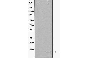 Western blot analysis of extracts of SGC7901, using CCL4 antibody. (CCL4 抗体  (Internal Region))