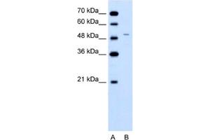 Western Blotting (WB) image for anti-Ferrochelatase (FECH) antibody (ABIN2462486) (FECH 抗体)