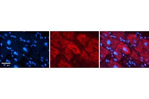 Rabbit Anti-NFATC1 Antibody    Formalin Fixed Paraffin Embedded Tissue: Human Adult heart  Observed Staining: Nuclear, Cytoplasmic Primary Antibody Concentration: 1:600 Secondary Antibody: Donkey anti-Rabbit-Cy2/3 Secondary Antibody Concentration: 1:200 Magnification: 20X Exposure Time: 0. (NFATC1 抗体  (N-Term))