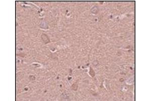 Immunohistochemistry of SRPX1 in human brain tissue with this product at 5 μg/ml. (SRPX 抗体  (N-Term))