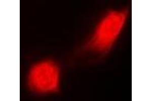 Immunofluorescent analysis of PSMC2 staining in MCF7 cells. (PSMC2 抗体)