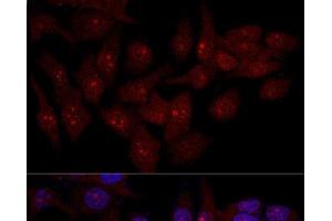 Confocal immunofluorescence analysis of Hela cells using EIF6 Polyclonal Antibody at dilution of 1:50. (EIF6 抗体)