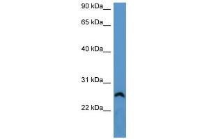 WB Suggested Anti-Frg1 Antibody Titration: 0. (FRG1 抗体  (Middle Region))