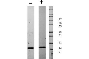 SDS-PAGE of Mouse CD40 Ligand Recombinant Protein SDS-PAGE of Mouse CD40 Ligand Recombinant Protein. (CD40 Ligand Protein (CD40LG))