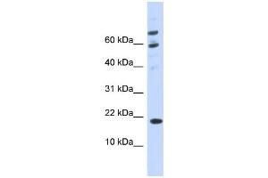 WB Suggested Anti-C21orf87 Antibody Titration:  0. (BRWD1-AS2 抗体  (C-Term))