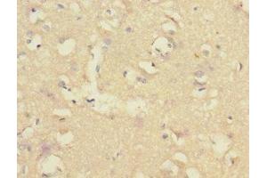 Immunohistochemistry of paraffin-embedded human brain tissue using ABIN7148480 at dilution of 1:100 (CNTNAP1 抗体  (AA 20-300))