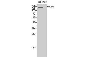 Western Blotting (WB) image for anti-Collagen, Type IV, alpha 2 (COL4A2) (N-Term) antibody (ABIN3184013) (COL4a2 抗体  (N-Term))
