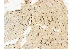 ABIN7094603 and ABIN7098653 at 1/100 staining Mouse heart tissue by IHC-P.