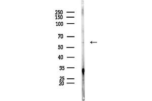 Western blot analysis of lysates from PC12 cells, using PPP3CB Antibody at 1/1000 dilution.