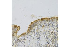 Immunohistochemistry of paraffin-embedded rat lung using PA2G4 Antibody (ABIN5973112) at dilution of 1/100 (40x lens). (PA2G4 抗体)
