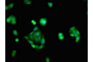 Immunofluorescent analysis of HepG2 cells using ABIN7153886 at dilution of 1:100 and Alexa Fluor 488-congugated AffiniPure Goat Anti-Rabbit IgG(H+L) (Glucocorticoid Receptor 抗体  (AA 1-190))