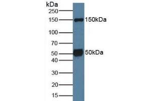 Detection of SGK1 in Mouse Brain Tissue using Polyclonal Antibody to Serum/Glucocorticoid Regulated Kinase 1 (SGK1) (SGK1 抗体  (AA 145-386))
