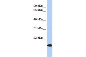 WB Suggested Anti-ARL17 Antibody Titration: 0. (ARL17 抗体  (Middle Region))