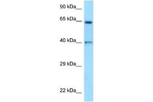 WB Suggested Anti-ANGPT1 Antibody Titration: 1. (Angiopoietin 1 抗体  (N-Term))