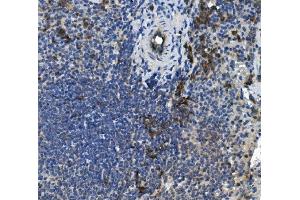 IHC analysis of PLSCR1 using anti-PLSCR1 antibody (ABIN7599471). (PLSCR1 抗体  (AA 1-54))