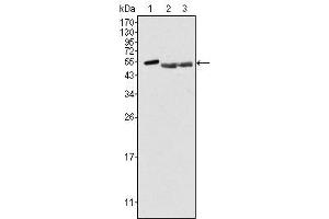 Western Blot showing PTK6 antibody used against Hela (1), A549 (2) and MCF-7 (3) cell lysate. (PTK6 抗体)