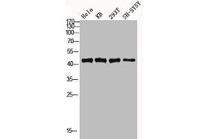 Western blot analysis of Hela KB 293T SH-SY5Y lysis using MKP-1/2 antibody. (MKP-1/2 抗体)