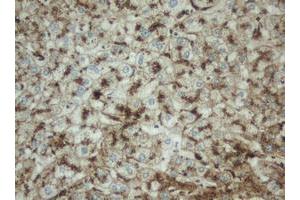 Image no. 2 for anti-Palmitoyl-Protein Thioesterase 1 (PPT1) (AA 100-306) antibody (ABIN1490802) (PPT1 抗体  (AA 100-306))