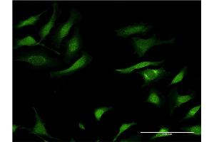 Immunofluorescence (IF) image for anti-serpin Peptidase Inhibitor, Clade A (Alpha-1 Antiproteinase, Antitrypsin), Member 3 (SERPINA3) (AA 25-423) antibody (ABIN513027)