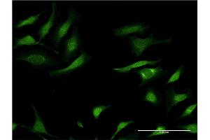 Immunofluorescence of monoclonal antibody to SERPINA3 on HeLa cell. (SERPINA3 抗体  (AA 25-423))