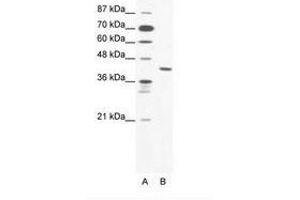 Image no. 1 for anti-Zinc Finger Protein 621 (ZNF621) (AA 208-257) antibody (ABIN203142) (ZNF621 抗体  (AA 208-257))