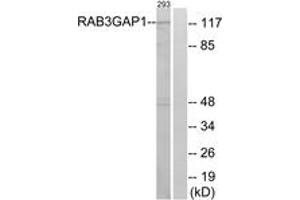 Western blot analysis of extracts from 293 cells, using RAB3GAP1 Antibody. (RAB3GAP1 抗体  (AA 538-587))