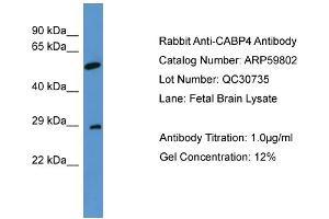 WB Suggested Anti-CABP4  Antibody Titration: 0. (CABP4 抗体  (N-Term))
