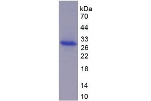 SDS-PAGE of Protein Standard from the Kit  (Highly purified E. (ADAM17 ELISA 试剂盒)