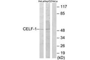 Western blot analysis of extracts from HeLa/HepG2 cells, using CELF-1 Antibody. (CELF1 抗体  (AA 71-120))