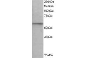 Western Blotting (WB) image for anti-Karyopherin alpha 3 (Importin alpha 4) (KPNA3) (C-Term) antibody (ABIN2465884) (KPNA3 抗体  (C-Term))