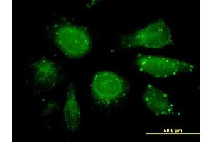 Immunofluorescence of purified MaxPab antibody to GDF3 on HeLa cell. (GDF3 抗体  (AA 1-364))