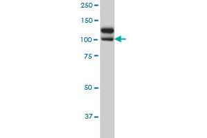 NEK9 monoclonal antibody (M01), clone 1F6 Western Blot analysis of NEK9 expression in HeLa .