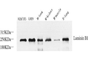 Western Blot analysis of various samples using Laminin beta1 Polyclonal Antibody at dilution of 1:800. (Laminin beta 1 抗体)