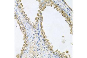 Immunohistochemistry of paraffin-embedded human prostate using HSP90AA1 antibody at dilution of 1:100 (x40 lens). (HSP90AA1 抗体)