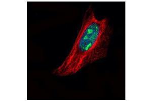 ICC/IF Image Confocal immunofluorescence analysis (Olympus FV10i) of paraformaldehyde-fixed HeLa, using TSPYL1, antibody (Green) at 1:500 dilution. (TSPYL1 抗体)