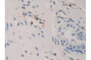 Immunohistochemistry (IHC) image for anti-Bone Morphogenetic Protein 15 (BMP15) (AA 266-388) antibody (ABIN7434677)