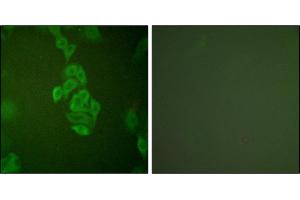 Immunofluorescence analysis of A549 cells, using NSE antibody. (ENO2/NSE 抗体)
