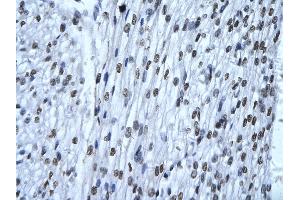 Rabbit Anti-XRCC6 Antibody       Paraffin Embedded Tissue:  Human cardiac cell   Cellular Data:  Epithelial cells of renal tubule  Antibody Concentration:   4.