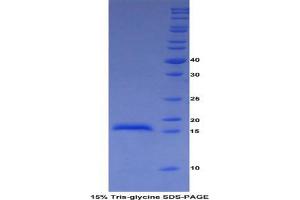 SDS-PAGE analysis of Cow ADAMTS2 Protein. (Adamts2 蛋白)