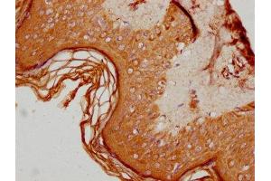 Immunohistochemistry (IHC) image for anti-Arachidonate 12-Lipoxygenase, 12R Type (ALOX12B) (AA 484-663) antibody (ABIN7144524)