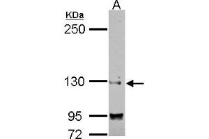 Western Blotting (WB) image for anti-Sin3A-Associated Protein, 130kDa (SAP130) (N-Term) antibody (ABIN1494118) (SAP130 抗体  (N-Term))