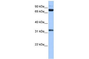 WB Suggested Anti-TAF6 Antibody Titration:  0.
