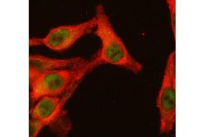IF analysis of NFAT1/NFATC2 using anti-NFAT1/NFATC2 antibody (ABIN7602742) and anti-Tubulin Alpha antibody (ABIN7600339).