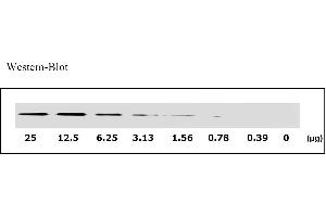 Image no. 3 for Epidermal Growth Factor Receptor (EGFR) ELISA Kit (ABIN625237) (EGFR ELISA 试剂盒)