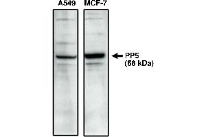 Western blot analysis using PP5 specific antibody on A549 and MCF-7 cell lysates. (PP5.2 抗体  (C-Term))