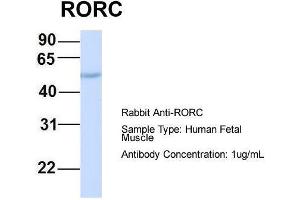 Host:  Rabbit  Target Name:  RORC  Sample Type:  Human Fetal Muscle  Antibody Dilution:  1. (RORC 抗体  (Middle Region))
