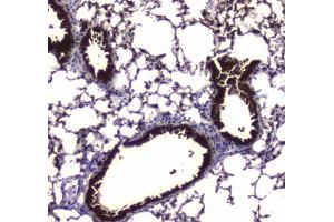 IHC testing of FFPE mouse lung tissue with Carboxylesterase 1 antibody at 1ug/ml. (CES1 抗体)