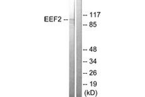 Western blot analysis of extracts from NIH-3T3 cells, treated with serum 10% 30', using eEF2 (Ab-56) Antibody. (EEF2 抗体  (AA 31-80))