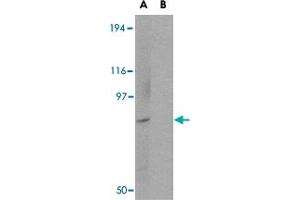 Western blot analysis of BICD1 in Daudi cell lysate with BICD1 polyclonal antibody  at 1 ug/mL in (A) the absence and (B) the presence of blocking peptide. (BICD1 抗体  (C-Term))
